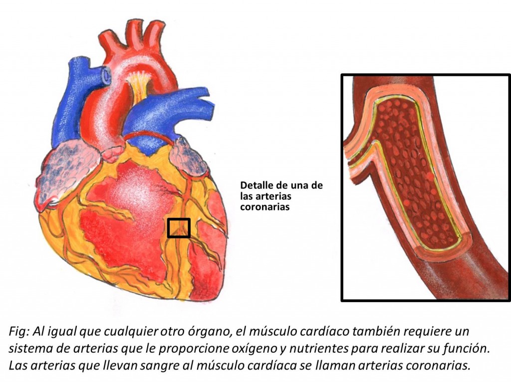 roble de nuevo referir Cardiopatía isquémica - CardiosaudeFerrol