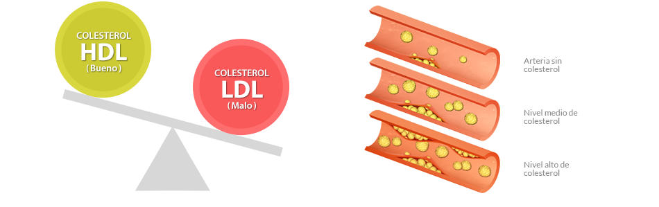 Trigliceridos colesterol